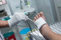 Understanding Foot Ulcers