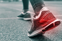 Running Shoes Can Depend on Your Arch
