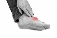 What Part of the Foot Does Gout Affect?